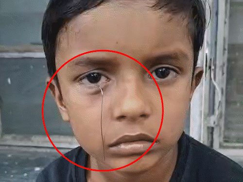 टॉय कार से निकला तार बच्चे की आंख में घुसा:घर में खेलते समय हादसा, पिता ने एक दिन पहले 250 रुपए में दिलाई थी